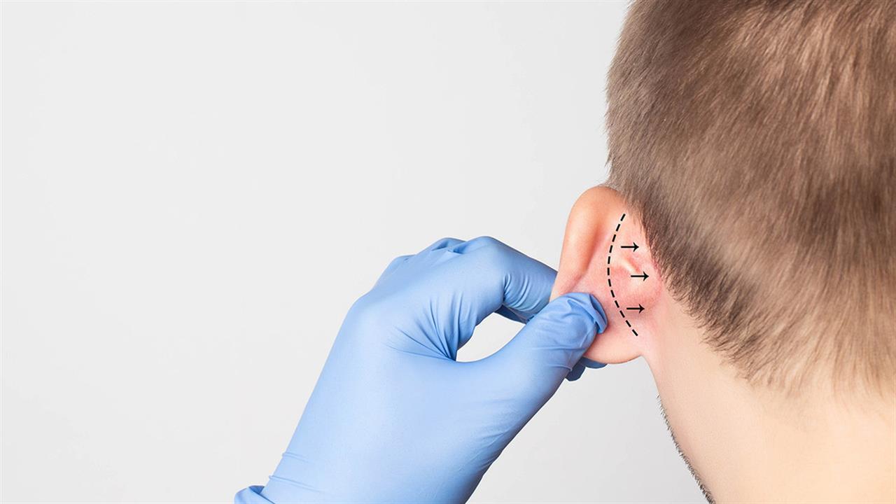 دليلك لأنواع عمليات تجميل الأذن بالأسعار ومواصفات الطبيب المثالي
